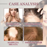 Onion Black Seed Hair Oil Spray for Natural Hair Care & Growth