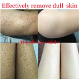 Keratosis Pilaris Skin Repair Cream