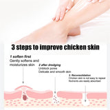 Keratosis Pilaris Skin Repair Cream