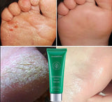 Calendula Foot Cream for Moisturizing and Repair