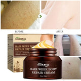 Keratosis Pilaris Skin Repair Cream