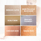 Keratosis Pilaris Skin Repair Cream