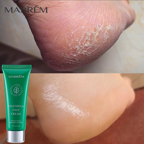 Calendula Foot Cream for Moisturizing and Repair