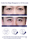 2 Minutes Instant Eye Bag Removal Cream