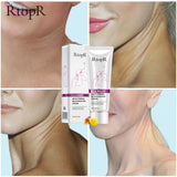 RtopR Neck Firming and Rejuvenating Cream
