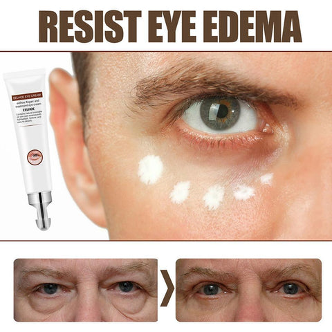 Eelhoe Peptide Collagen Eye Bag Removal Cream for Eye Puffiness and Wrinkles