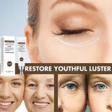 Eelhoe Peptide Collagen Eye Bag Removal Cream for Eye Puffiness and Wrinkles