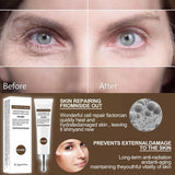 Eelhoe Peptide Collagen Eye Bag Removal Cream for Eye Puffiness and Wrinkles